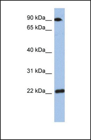 Anti-TMED10 antibody produced in rabbit