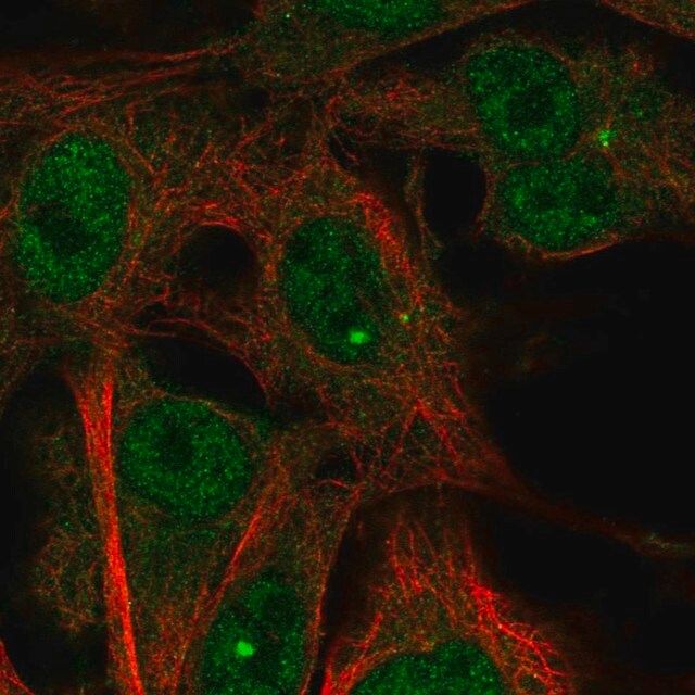 Anti-TMEM169 antibody produced in rabbit