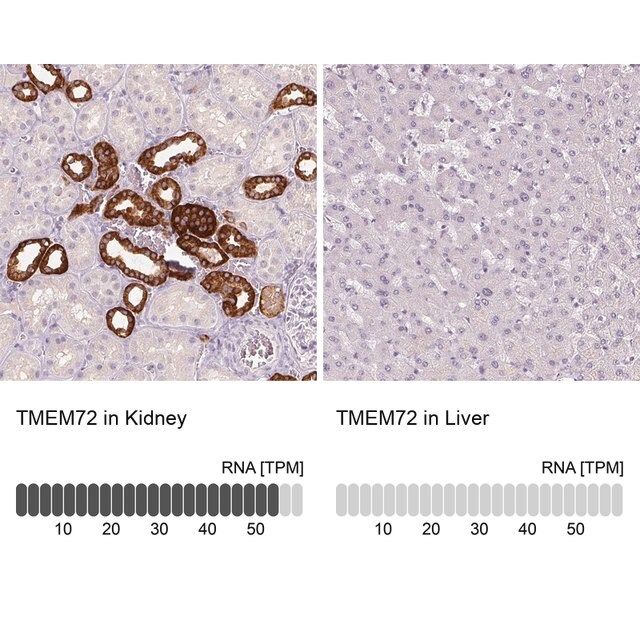 Anti-TMEM72 antibody produced in rabbit