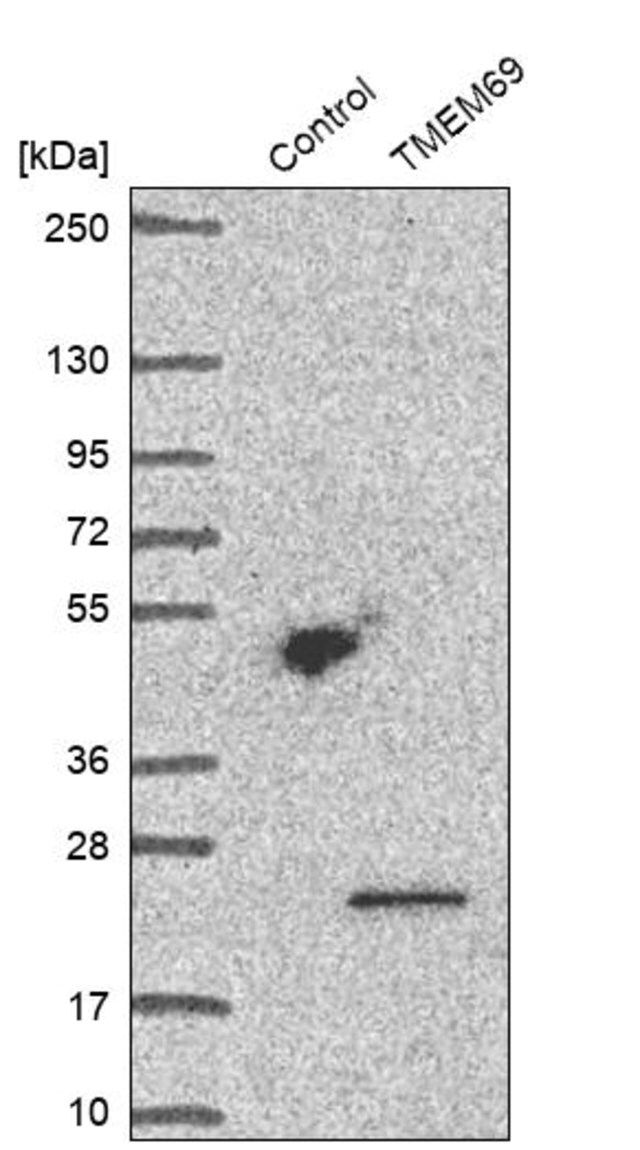 Anti-TMEM69 antibody produced in rabbit