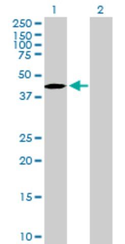 Anti-TBC1D20 antibody produced in mouse