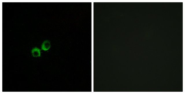 Anti-TAS1R3 antibody produced in rabbit