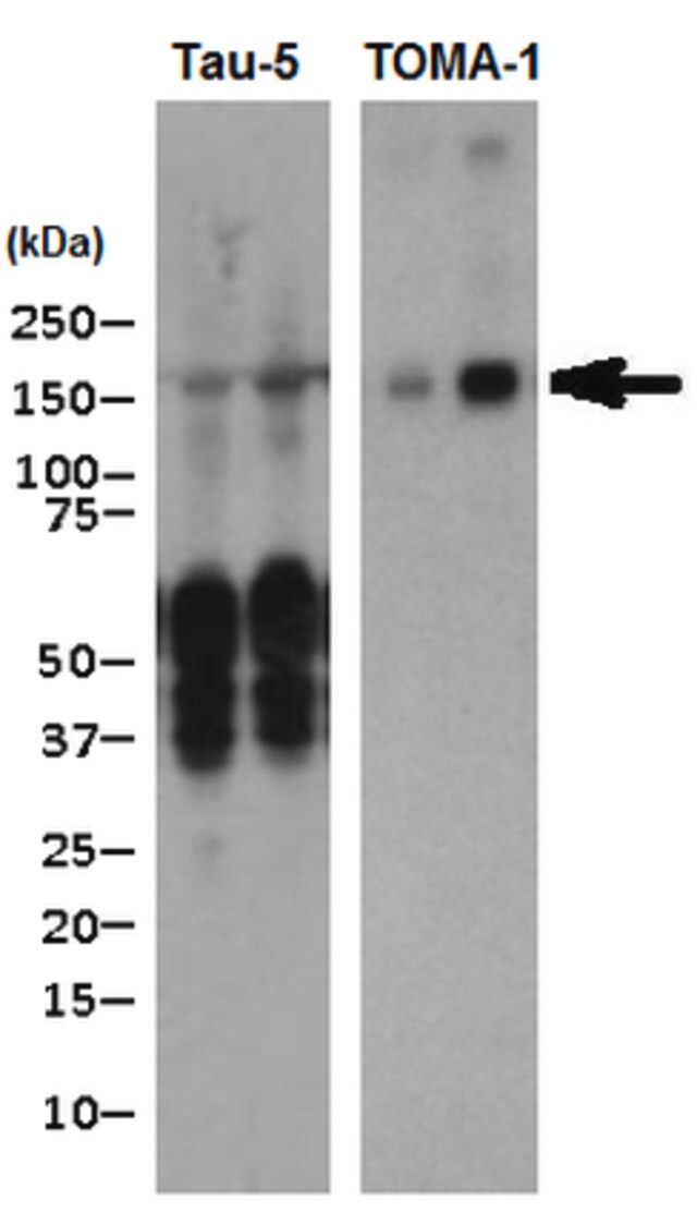 Anti-Tau Antibody, oligomeric Antibody, clone TOMA-1