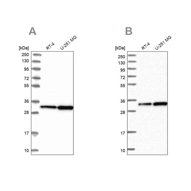 Anti-TBCB antibody produced in rabbit