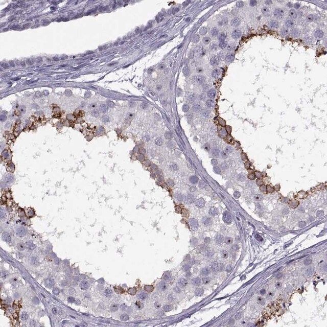 Anti-TBC1D3C antibody produced in rabbit