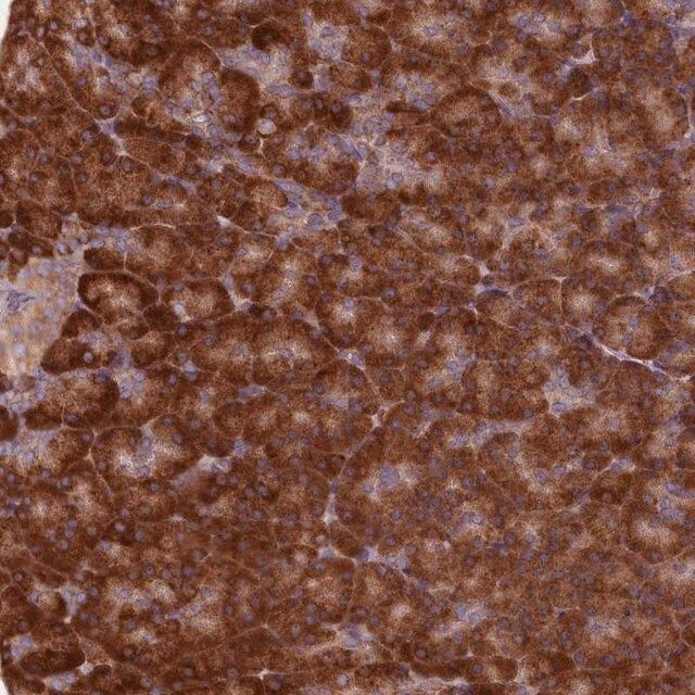 Anti-TBC1D19 antibody produced in rabbit