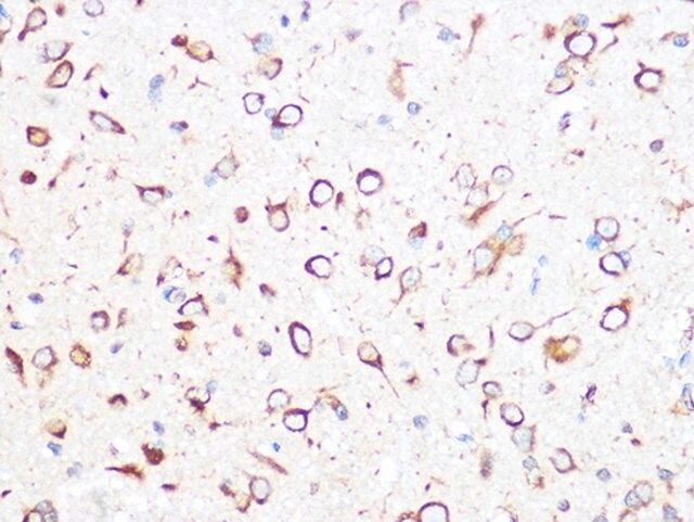 Anti-TCP1 beta/CCT2 antibody produced in rabbit