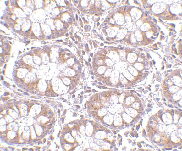 Anti-TEM1 (ab1) antibody produced in rabbit