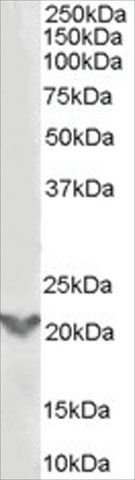 Anti-TGIF2 antibody produced in goat