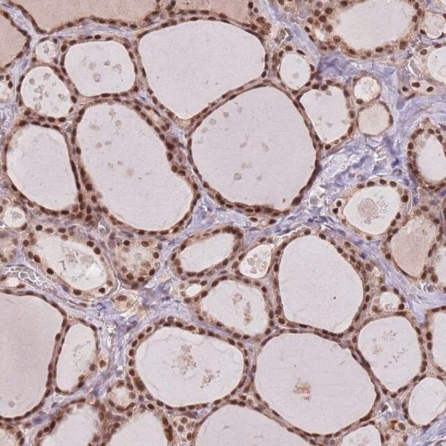 Anti-SUDS3 antibody produced in rabbit