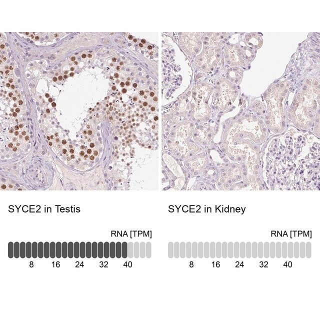 Anti-SYCE2 antibody produced in rabbit