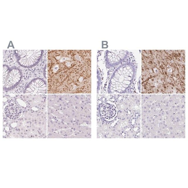 Anti-SYNPR antibody produced in rabbit