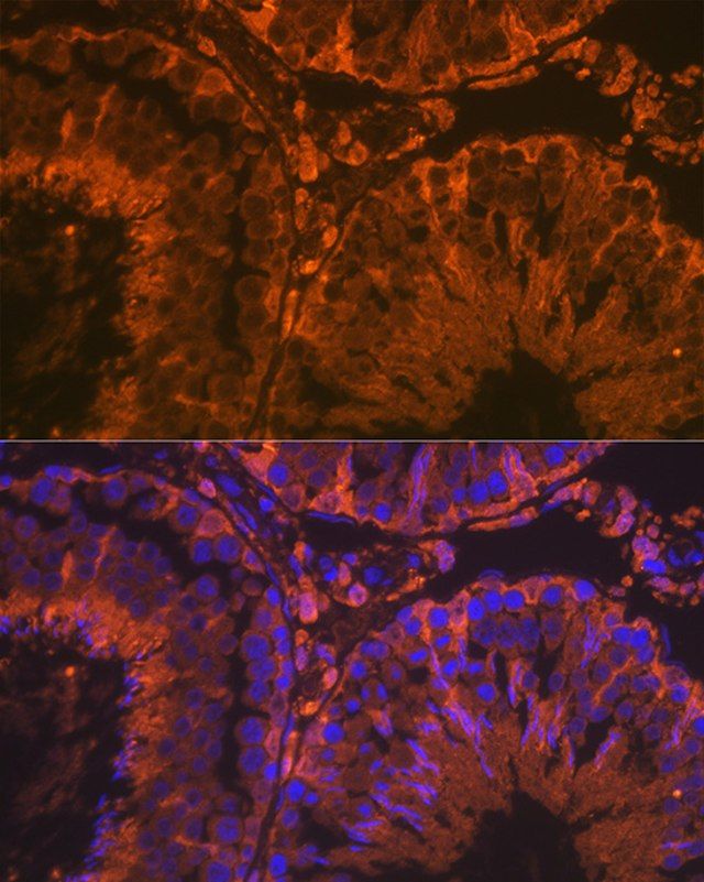 Anti-SRD5A2 antibody produced in rabbit