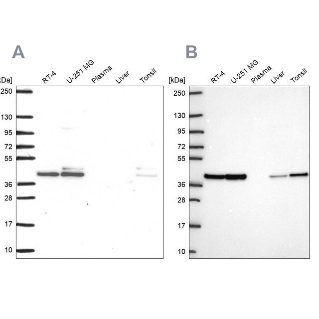 Anti-STRAP antibody produced in rabbit