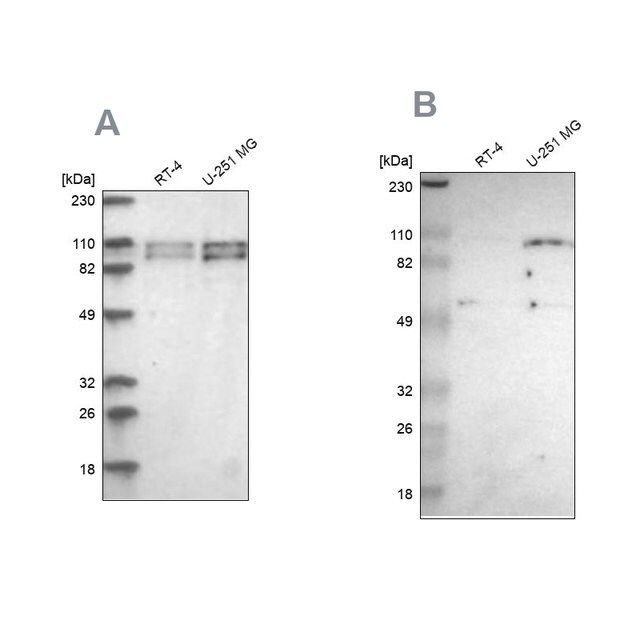 Anti-STRN3 antibody produced in rabbit