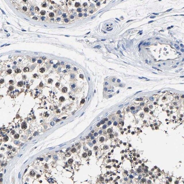 Anti-STRBP antibody produced in rabbit