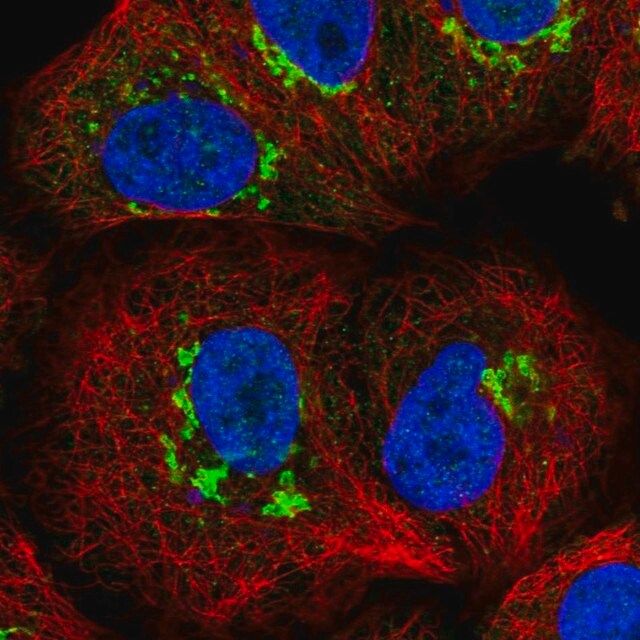 Anti-ST8SIA4 antibody produced in rabbit