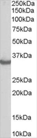 Anti-STUB1/CHIP antibody produced in goat