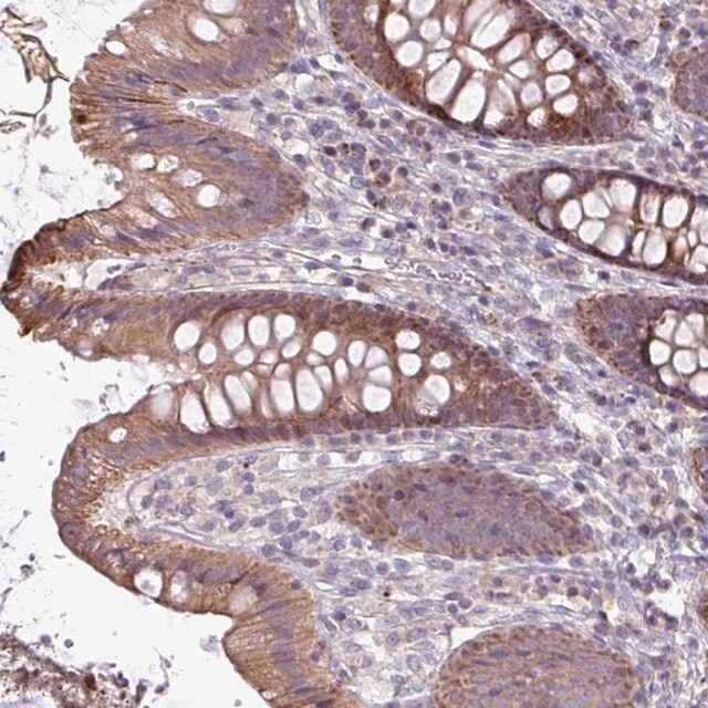 Anti-STRIP1 antibody produced in rabbit