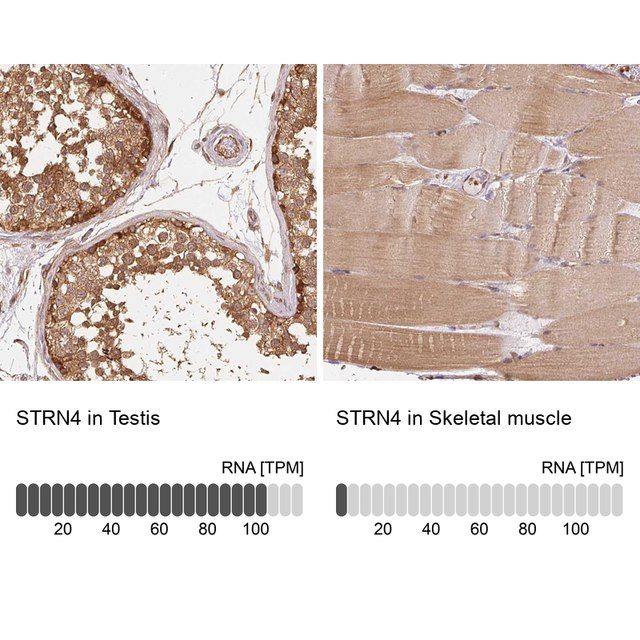 Anti-STRN4 antibody produced in rabbit