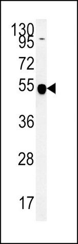 ANTI-ST8SIA5 (CENTER) antibody produced in rabbit