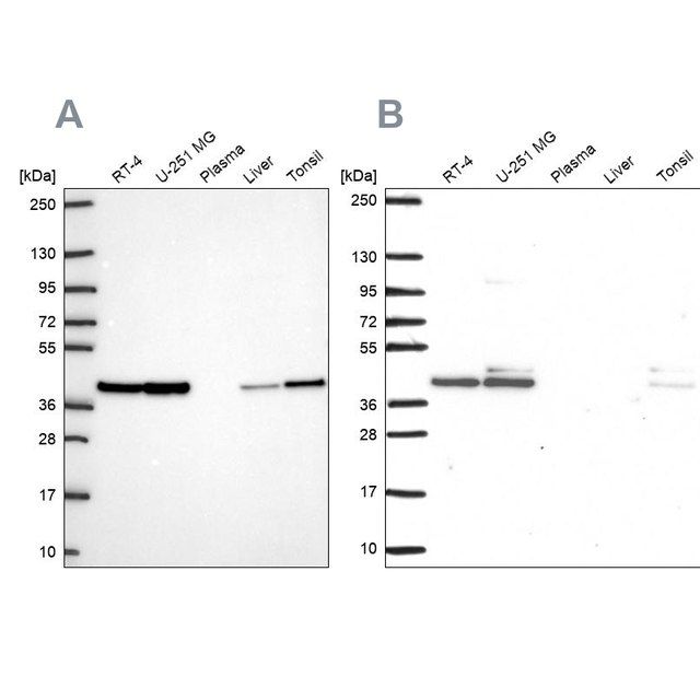 Anti-STRAP antibody produced in rabbit