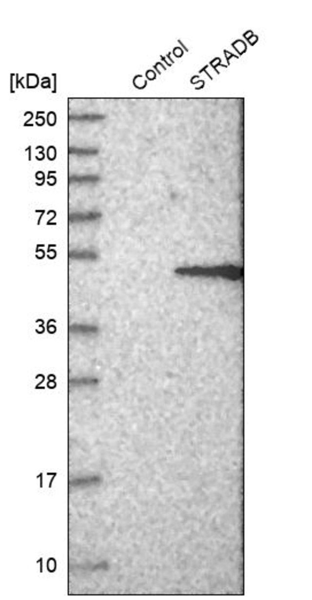 Anti-STRADB antibody produced in rabbit