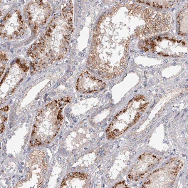 Anti-STRADB antibody produced in rabbit