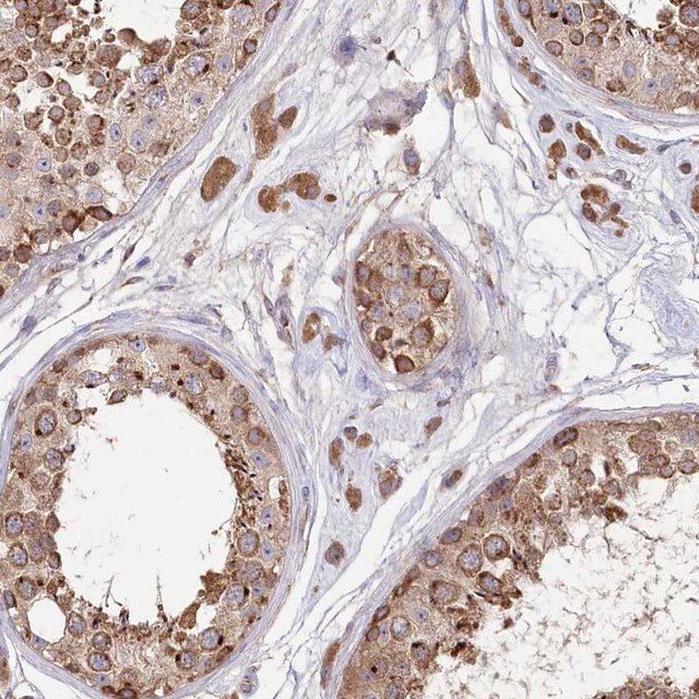 Anti-STT3B antibody produced in rabbit