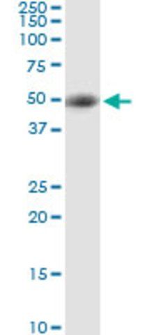 Anti-STRADA antibody produced in rabbit