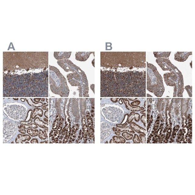 Anti-SUCLG1 antibody produced in rabbit