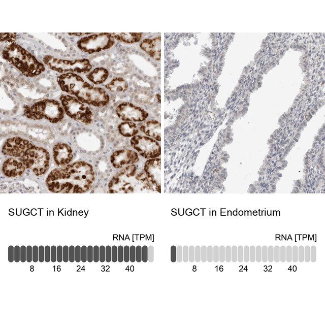 Anti-SUGCT antibody produced in rabbit