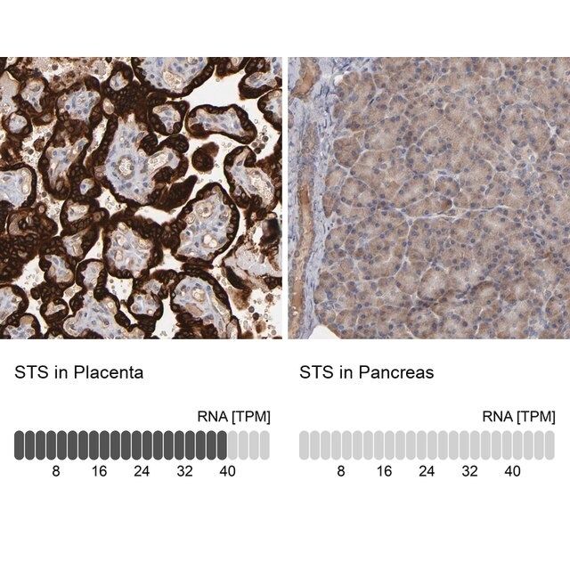 Anti-STS antibody produced in rabbit