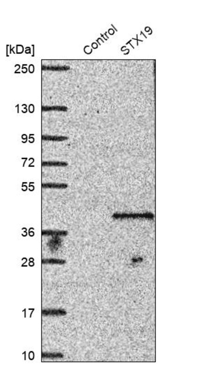 Anti-STX19 antibody produced in rabbit