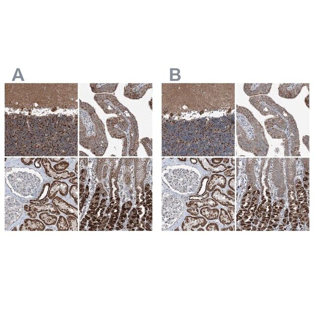 Anti-SUCLG1 antibody produced in rabbit