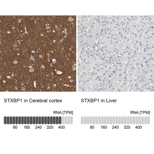 Anti-STXBP1 antibody produced in rabbit