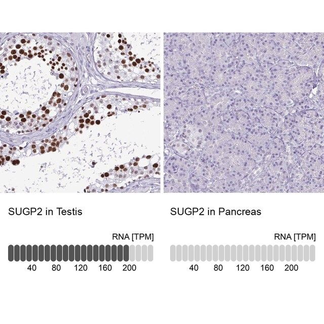 Anti-SUGP2 antibody produced in rabbit