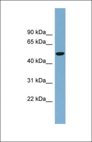 Anti-SLC2A8 antibody produced in rabbit