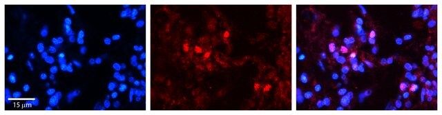 Anti-SNRP70 antibody produced in rabbit