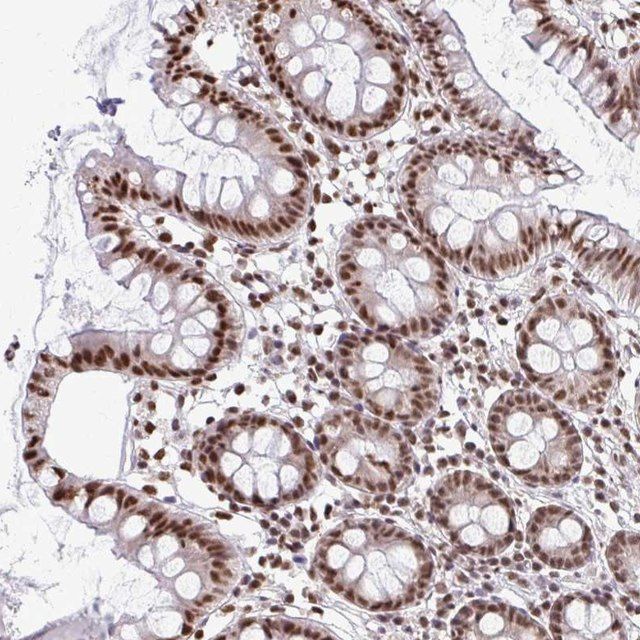 Anti-SNRPA antibody produced in rabbit