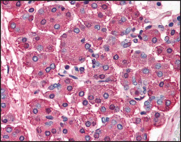 Anti-SKI antibody produced in rabbit