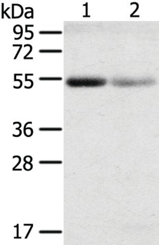 Anti-SLC17A1