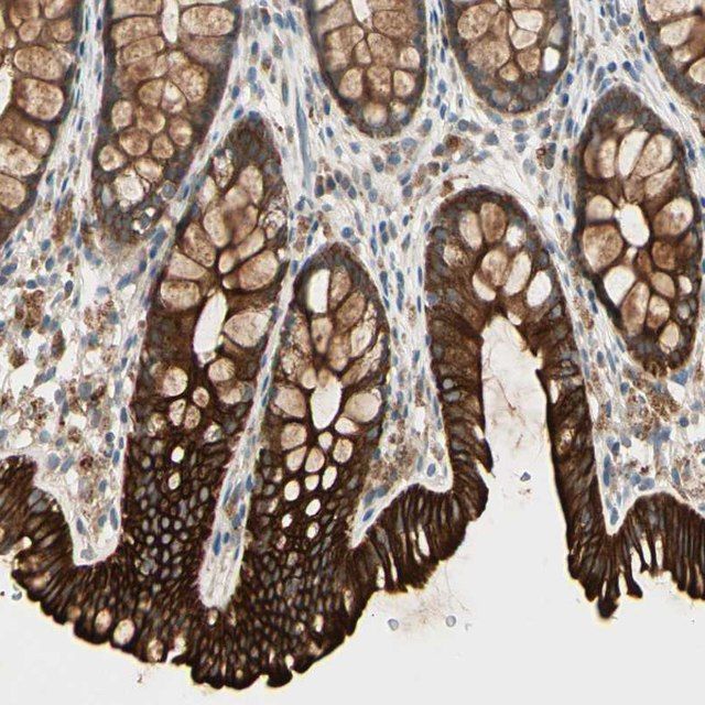 Anti-SKIL antibody produced in rabbit