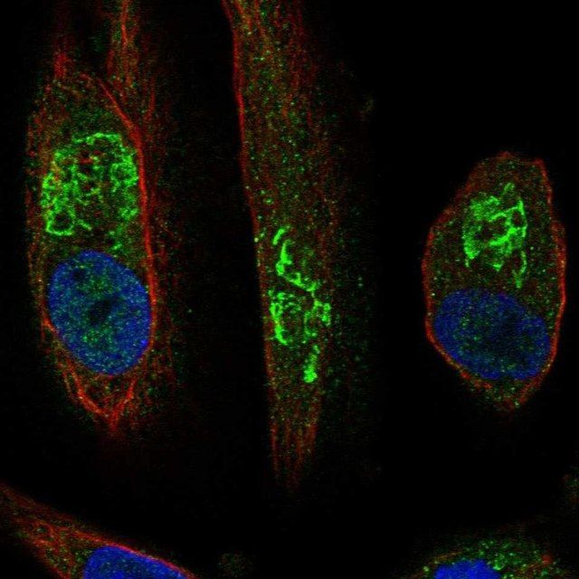 Anti-SLC17A1 antibody produced in rabbit