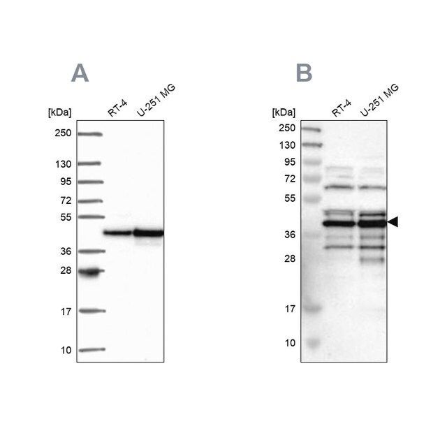 Anti-SLBP antibody produced in rabbit