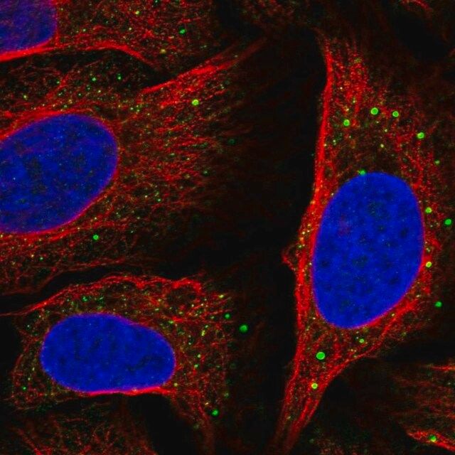 Anti-SLC14A1 antibody produced in rabbit