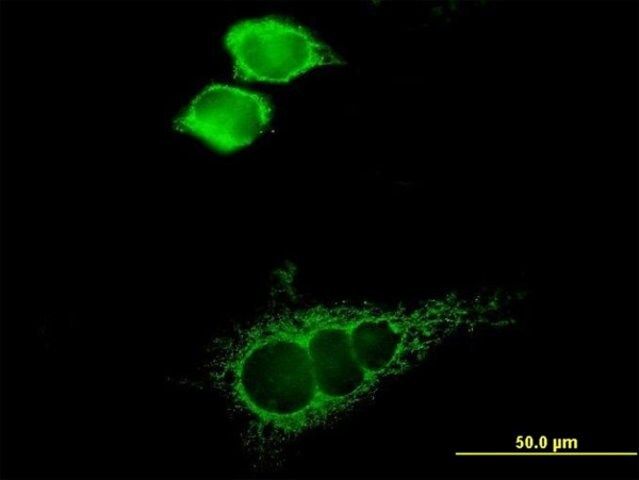 Anti-SLC16A1 antibody produced in mouse