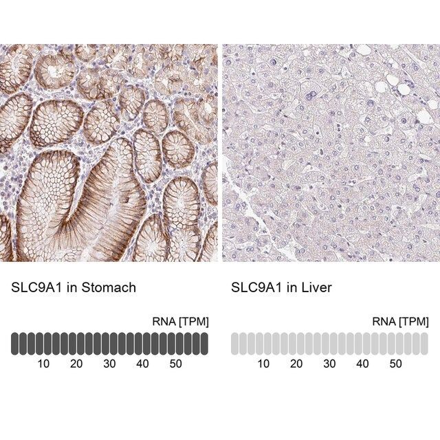 Anti-SLC9A1 antibody produced in rabbit