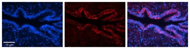 Anti-SLC16A1 antibody produced in rabbit