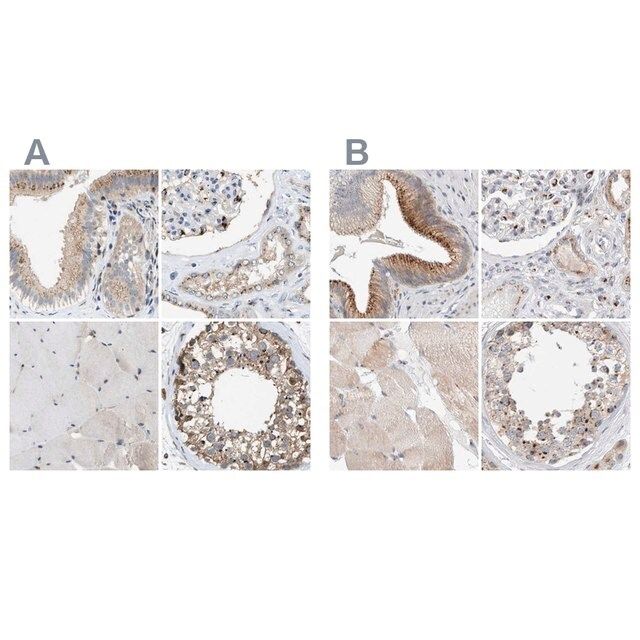 Anti-SLC38A10 antibody produced in rabbit